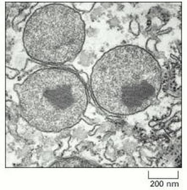 Peroxisome Structure - Peroxisomes