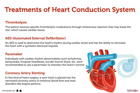 Heart Conduction System (Human Anatomy): Picture , Functions, Diseases, and Treatments