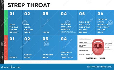 Vector Infographic with Strep Throat Symptoms. Some of Them are: Sore ...