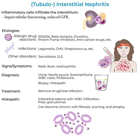 Clinical Pathology Glossary: Acute Tubular Necrosis & Interstitial ...