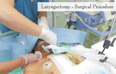 Laryngectomy - Procedure, Risks and Post Laryngectomy Therapy