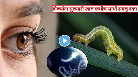 60 Alive Worms Removed From Womens Eyes After She Complains Itching In Eyes Doctor Tells How ...