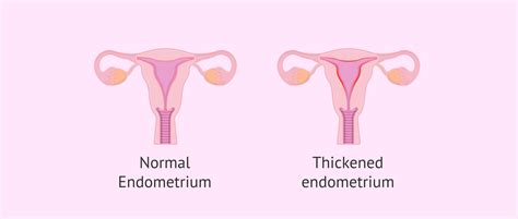 Normal Endometrial Cells