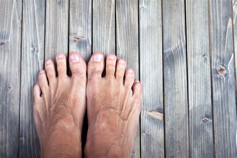 Toenail Removal Surgery - Everything You Need to Know | GNFO