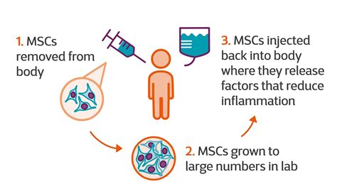 First results of new stem cell therapy trial announced | MS Society