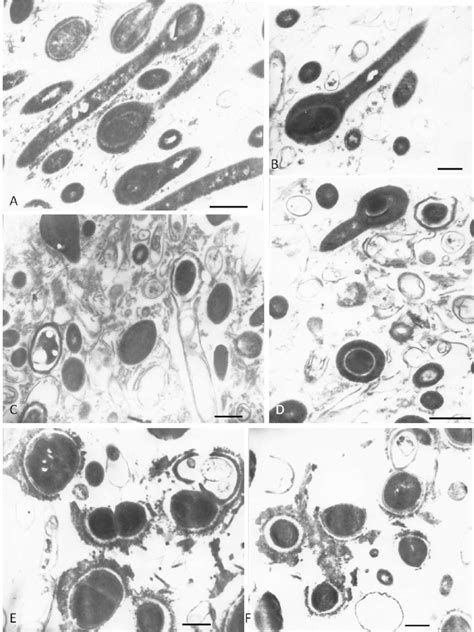 Transmission electron microscopy of Mycobacterium tuberculosis L-forms ...