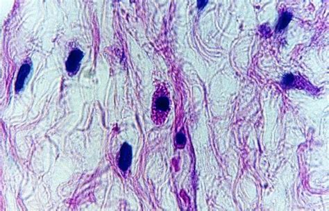 Plantão Médico: Histología del Tejido Conectivo Ordinario