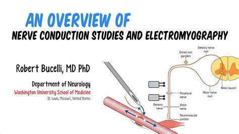 Nerve Conduction Study Video