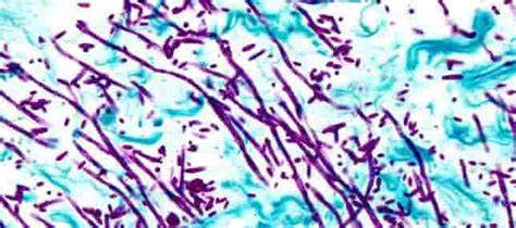 PAS Stain Kit for fungal cell walls (modified McManus 1946) - iqmstore