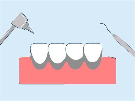 Black Tartar on Teeth: Causes, Symptoms, and Treatment