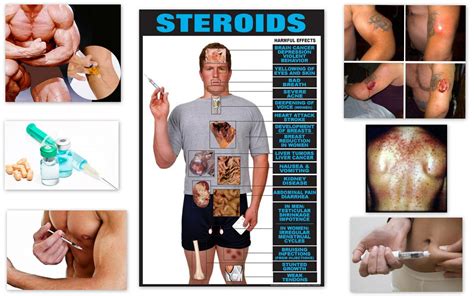 All about Steroids ~ FITNESS FREAK