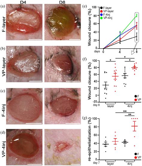 Therapeutic arteriogenesis by factor-decorated fibrin matrices promotes ...