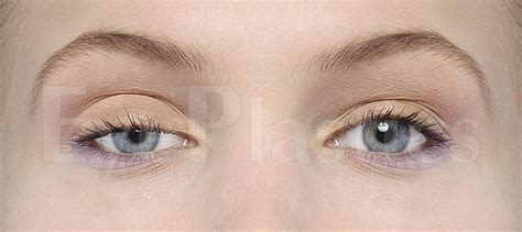 Cosmetic eyelid surgery, oculofacial Oculo-facial) surgeon locatetest