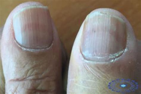 Things Your Nails Can Tell You About Your Health – Femanin