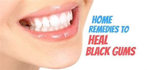 10 Promising Home Remedies to Heal Black Gums Naturally