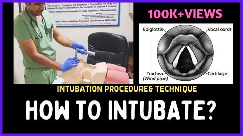 Endotracheal Intubation Video