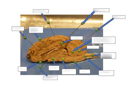 sheep brain dissection (pt6) Diagram | Quizlet