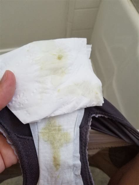 Green/yellow discharge?? (TMI pics!) - September 2019 Babies | Forums ...