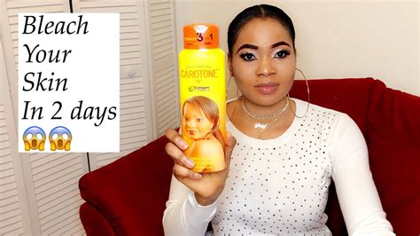 Larry Elder Skin Bleaching / Nigeria's newest skin-bleaching, cross-dressing Snapchat ... / The ...