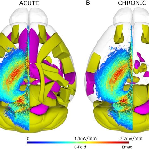 Spatial representation superficial brain regions with significantly... | Download Scientific Diagram