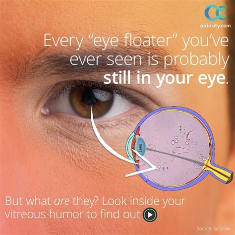 Pin by Broome Optical on Eye Trivia | Eye facts, Eye floaters causes, How to find out