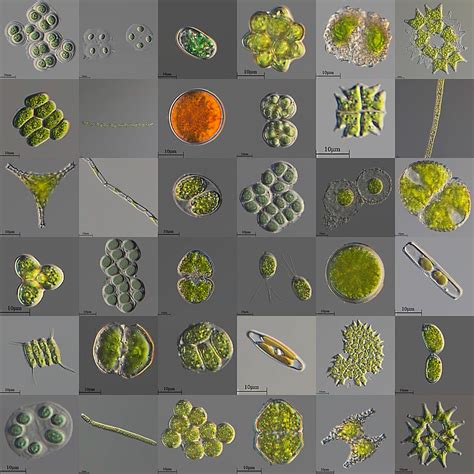 A variety of microscopic unicellular and colonial freshwater algae | Algae, Tissue types, Logo ...