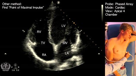 Get Your Best APICAL Chamber View With POCUS Point-of-Care, 44% OFF