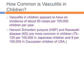 Pediatric vasculitides | PPT