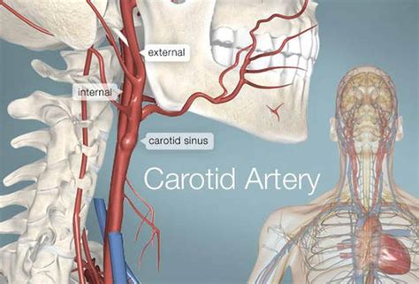 Pictures Of Carotid Arteries