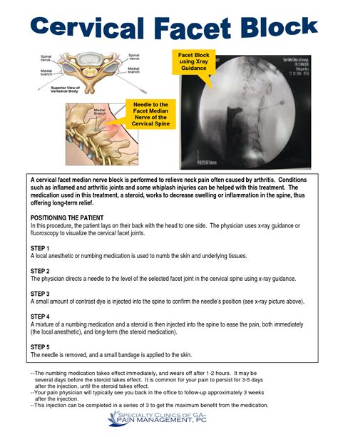 Neck Facet Joint Injections Side Effects | cervical facet median nerve block is performed to ...