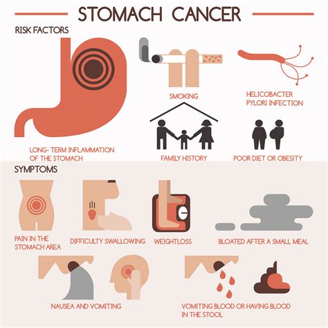 Gastric Cancer - Hematology & Oncology | Cancer Care Center | Edison ...