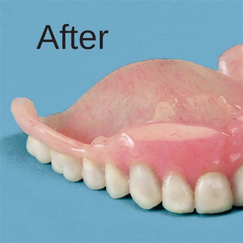 Buy Denture Repair Kit With Teeth - TeethWalls