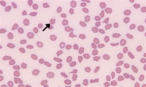 Keratocytes – Cells and Smears