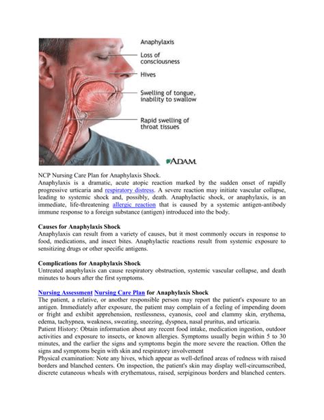 NCP Nursing Care Plan for Anaphylaxis Shock. Anaphylaxis is a