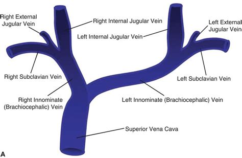 Image result for brachiocephalic vein and subclavian vein | Basic ...