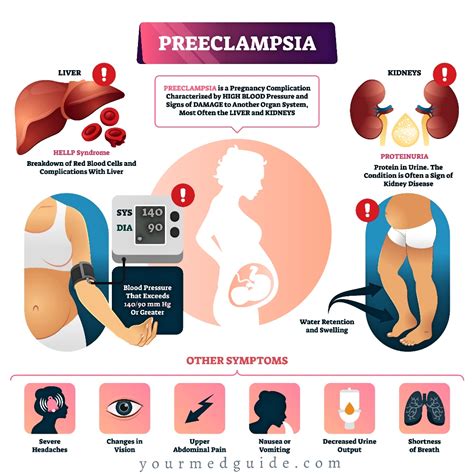 Everything You Should Know About Preeclampsia and Pregnancy - Your Med Guide