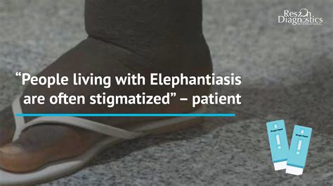 People living with Elephantiasis are often stigmatized - Reszonics