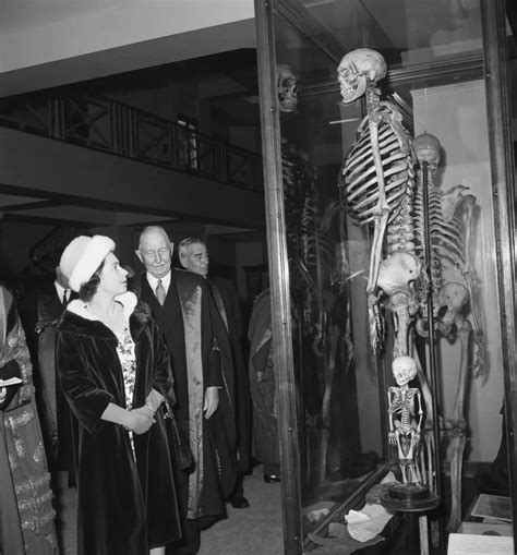 Why the Hunterian Museum Is Removing the Skeleton of 'Irish Giant' Charles Byrne From View ...