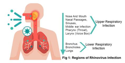 Rhinovirus Infection - Symptoms | Treatment | Prevention