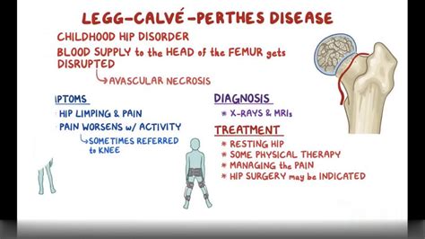 Legg Calve Perthes Disease- Causes, Symptoms, Diagnosis & Treatment ...