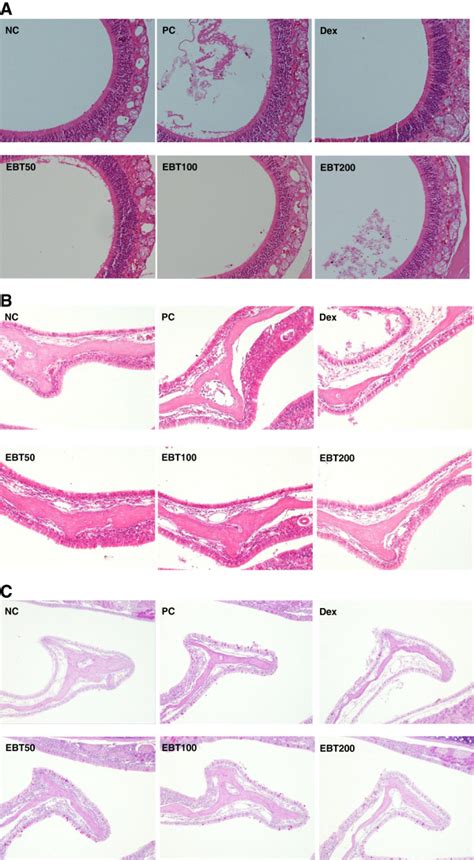 Histological analysis of nasal mucosa tissue. Eighteen hours after the ...