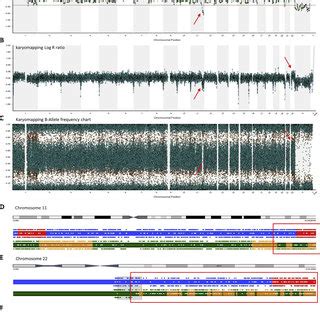 Segmental aneuploidy detection by karyomapping and array comparative... | Download Scientific ...