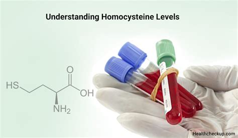 High Homocysteine Levels- Causes & Treatment By Dr. Ahmed