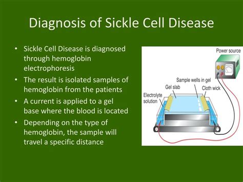 PPT - Sickle Cell Disease PowerPoint Presentation, free download - ID:5662658