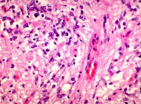 Neurohypophysis of the horse with nerve fibers and pituicytes – Collection of Histology Images