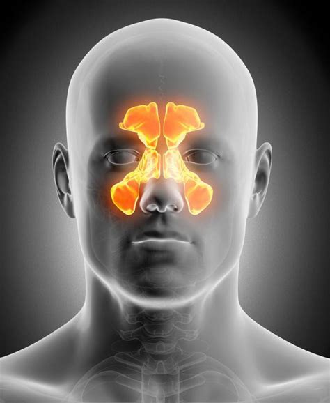 Sinus surgery Maxillary Antrostomy