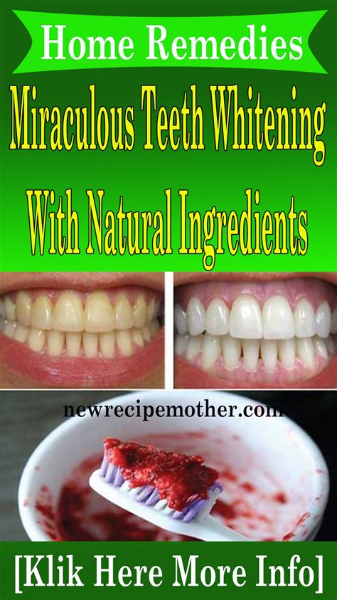 Miraculous Teeth Whitening Home Remedies With Natural Ingredients ...