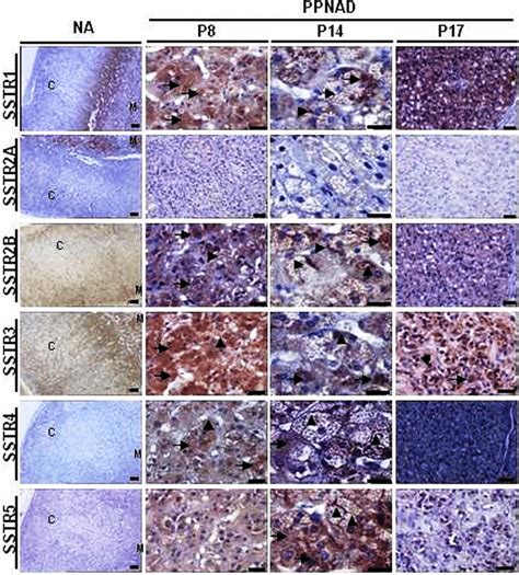 Immunohistochemical analysis of somatostatin receptors expression in... | Download Scientific ...