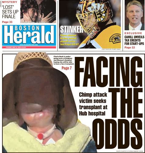 Chimp attack victim Charla Nash rebuilding life – Boston Herald