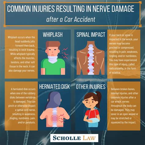 sciatica after car accident compensation - yuki-friemering